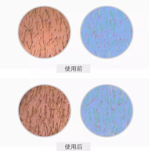 楊冪發際線變低還長出許多小絨毛,真的去植發了